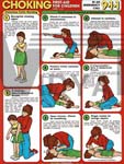 Choking First Aid For Children Chart